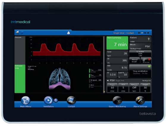 VentSum.png (175 KB)